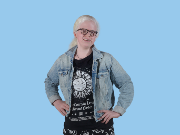 Buitenkant: ‘Als mensen staren ga ik het gesprek niet aan’